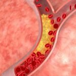6 Powerful Effects of Tadalafil Tablets on Blood Flow